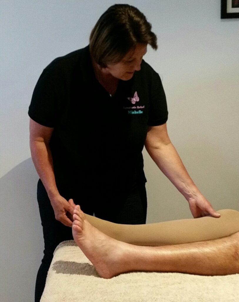 Lymphoedema Therapy Corio Bay Sports Treatment Clinic Colac