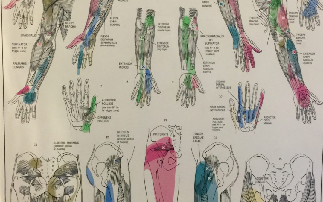 Trigger Points common in Colac