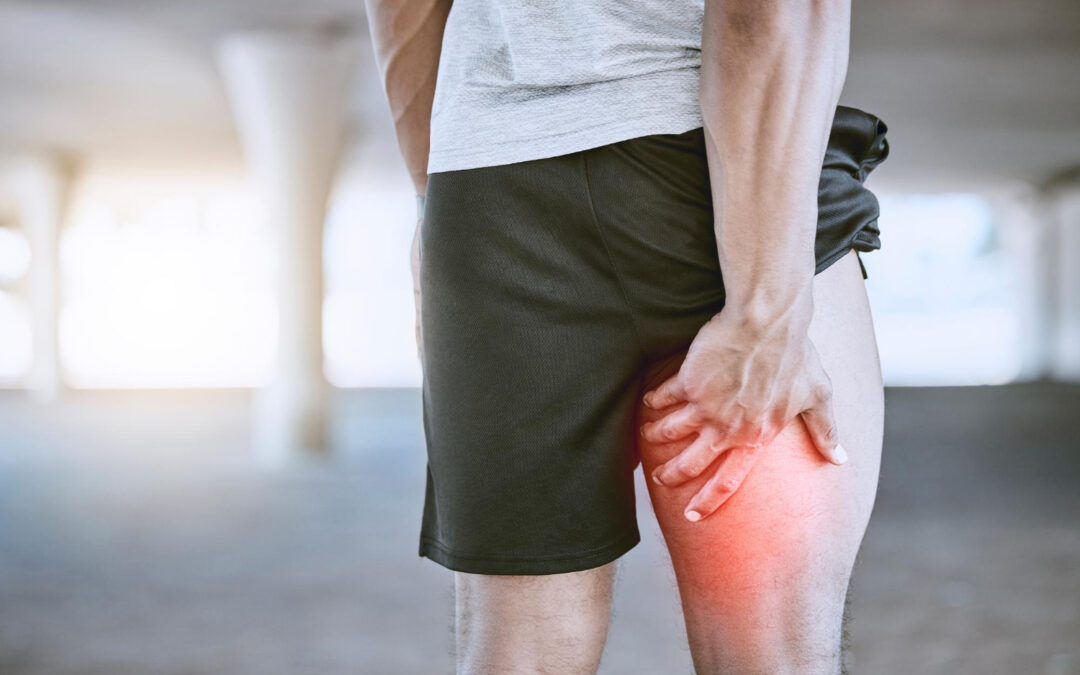 Preventing Recurrent Hamstring Strains: A Complete Guide