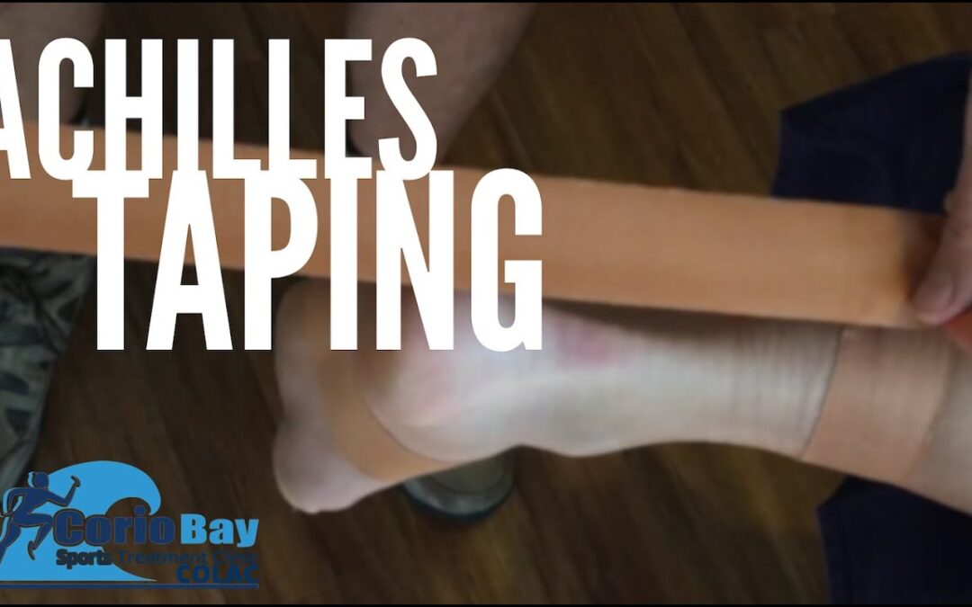 How To Tape An Achilles (with rigid tape)